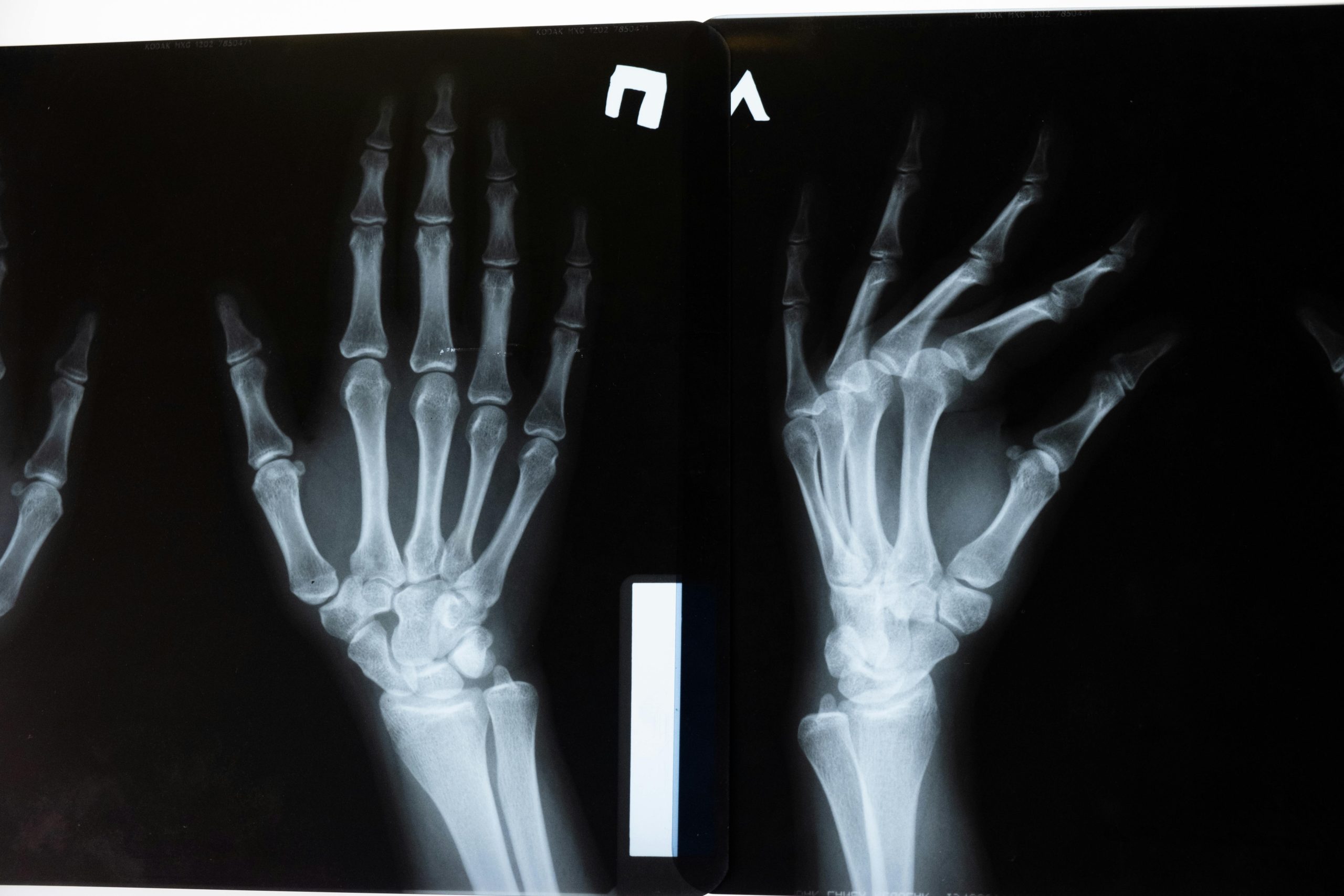 On-Site X-Ray Fort Meade | Fast & Accurate Imaging Services